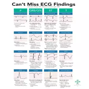 ECG Cant Miss Findings Card v2